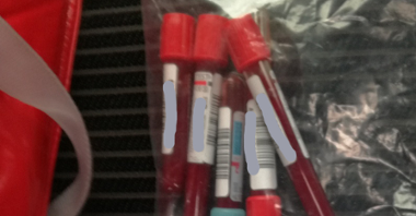 Odnalezione próbki krwi